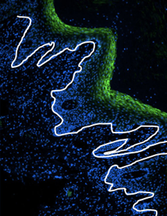 Representation of HIV Vaccine Representation of HIV Vaccine