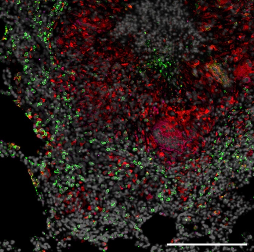 Fluorescent microscopy image of lung tissue demonstrating effectiveness of inhibiting IDO to reduce inflammation.
