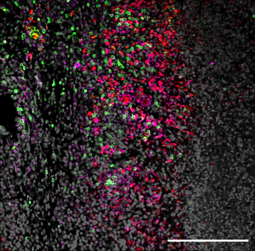 Fluorescent microscopy image of lung tissue showing high levels of IDO are present during SIV and TB co-infection under cART treatment.