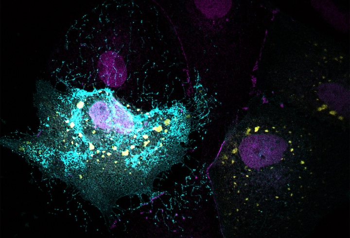 Fluorescent microscopy shows ebola virus particles spreading