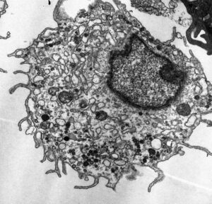 AML Cells