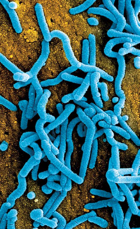 Marburg virus particles. Photo courtesy of NIH.