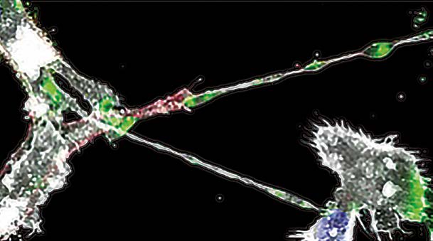 Ebola virus proteins (green) are detected in tunneling nanotubes connecting cells.