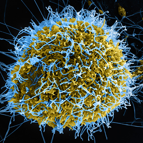 Ebola Virus Particles Ebola Virus Particles