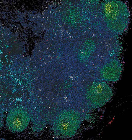 A lymph node containing SIV RNA (red dots), B cell zones (green) and T cell zones (blue).