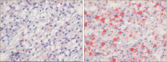 Lipid In Liver